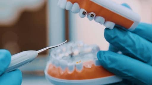 Tyler Cosmetic Dental Services That Enhance Your Smile