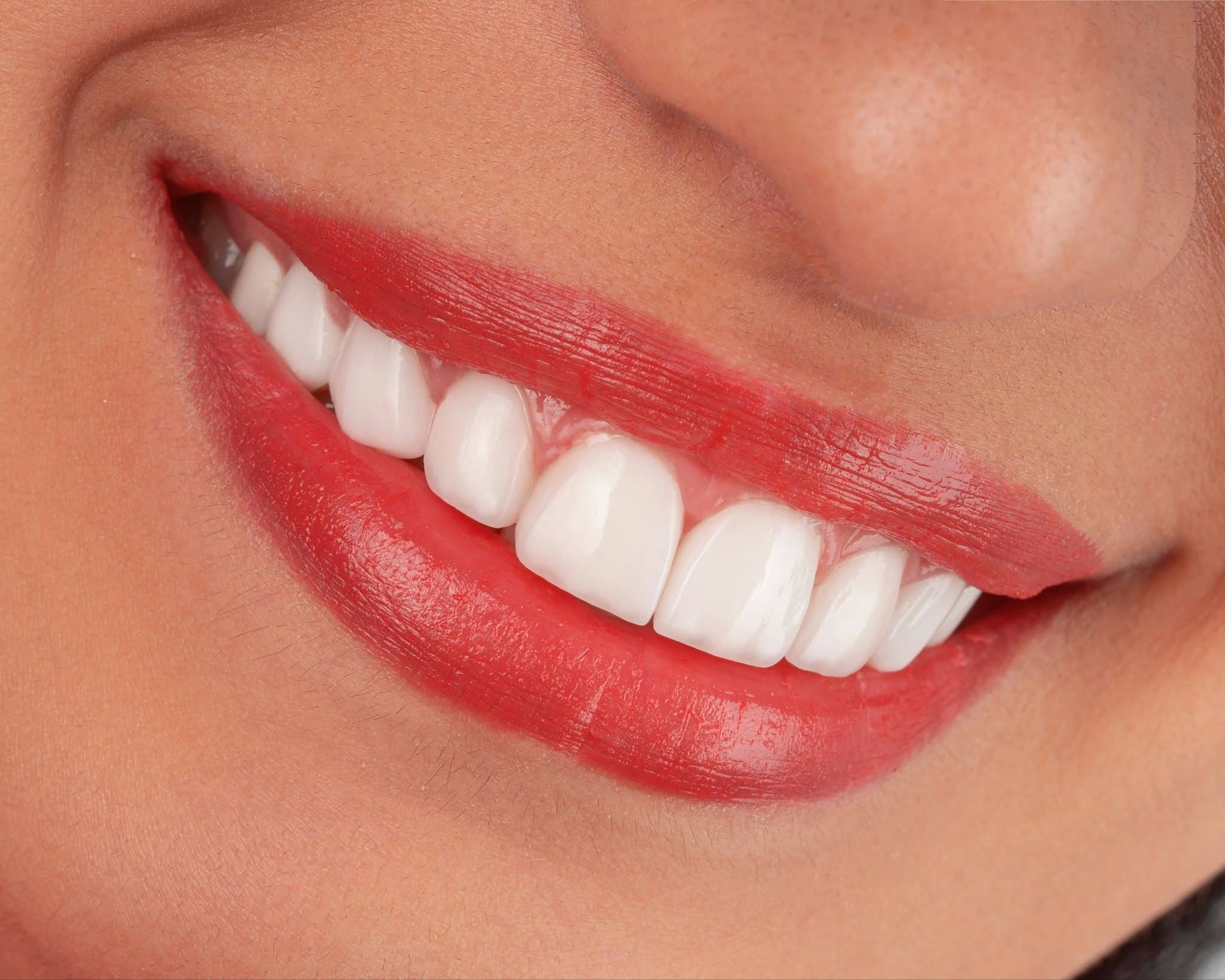 Smile Makeovers in Tyler, TX: What Cosmetic Dentistry Can Do