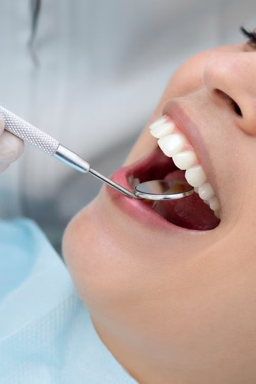 Teeth Whitening Tyler TX: Safe, Fast Cosmetic Options