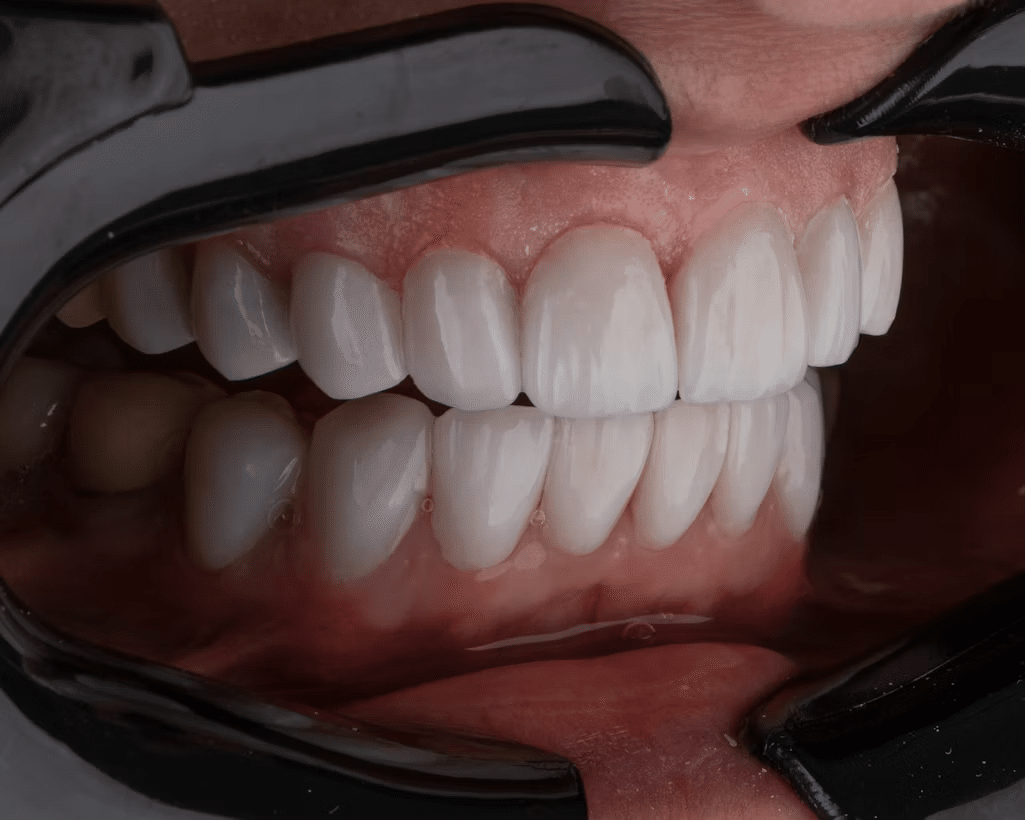 cosmetic dentistry Tyler TX