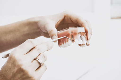 Benefits of Cosmetic Dentistry for a Confident Smile in Tyler